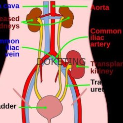 Cpt code for cerclage removal