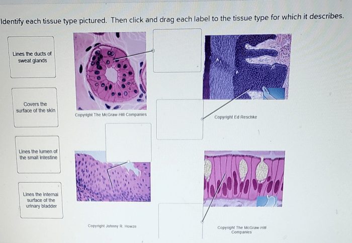 Label the the tissues and structures on the histology slide